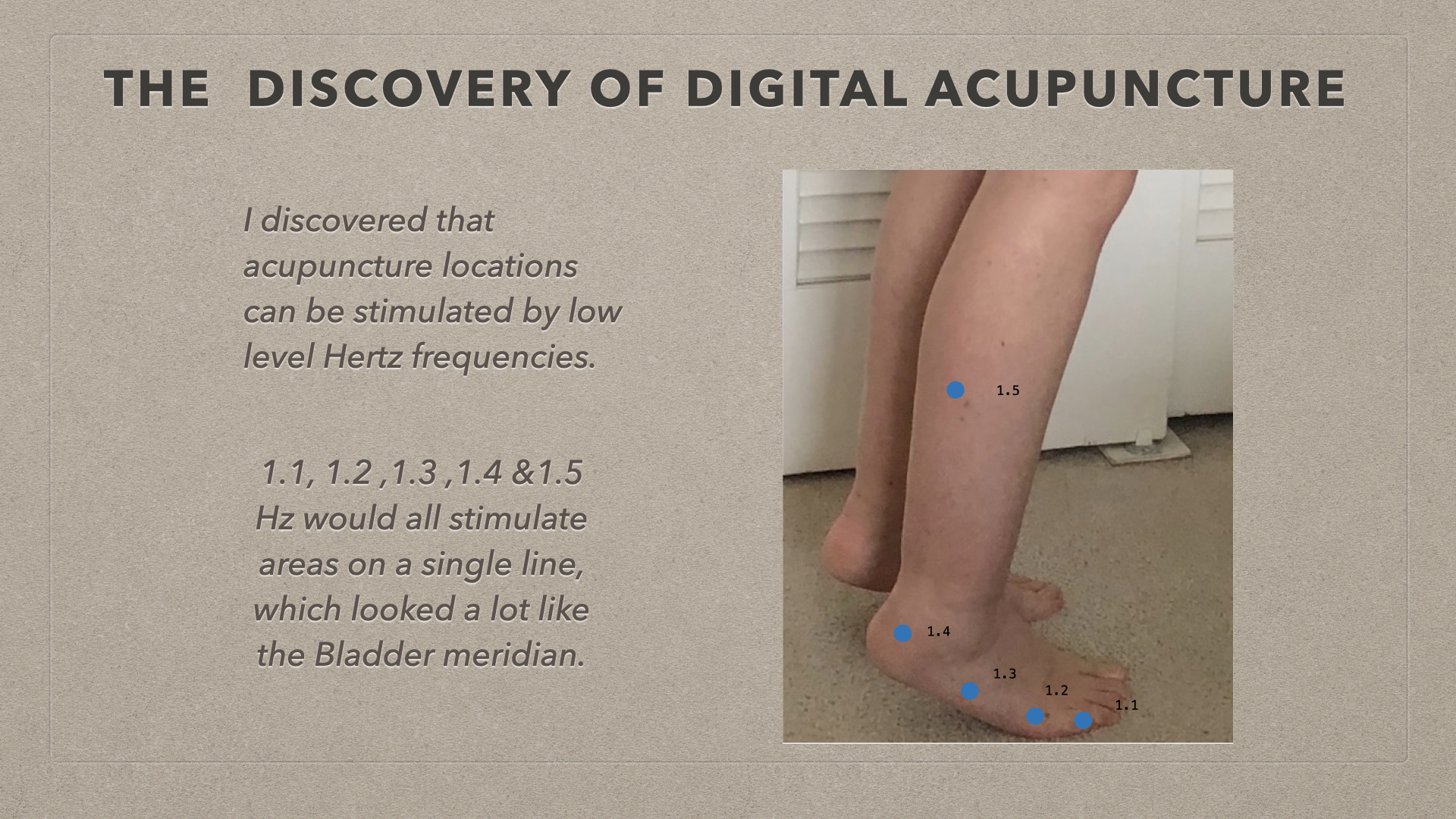 the  discovery of digital acupuncture